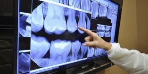Dentist pointing at a dental X-ray on a screen.